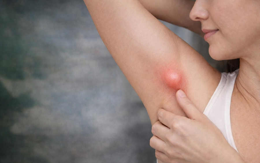 KOLTUK ALTINDAKİ ŞİŞLİK HER ZAMAN MASUM DEĞİL: EKTOPİK MEME DOKUSU UYARISI